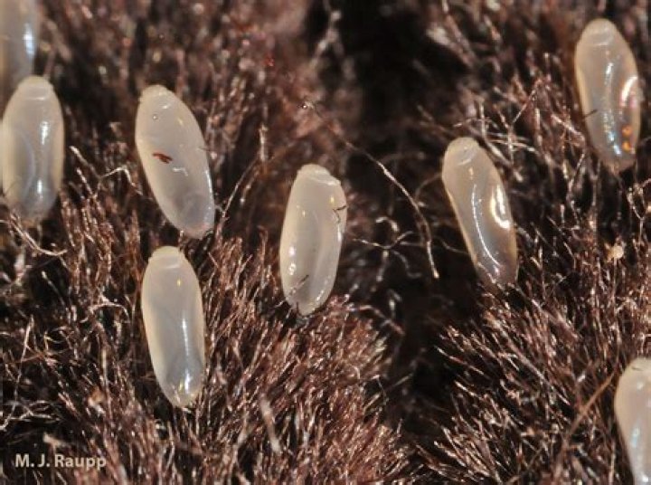 Are lice eggs bigger than dandruff?