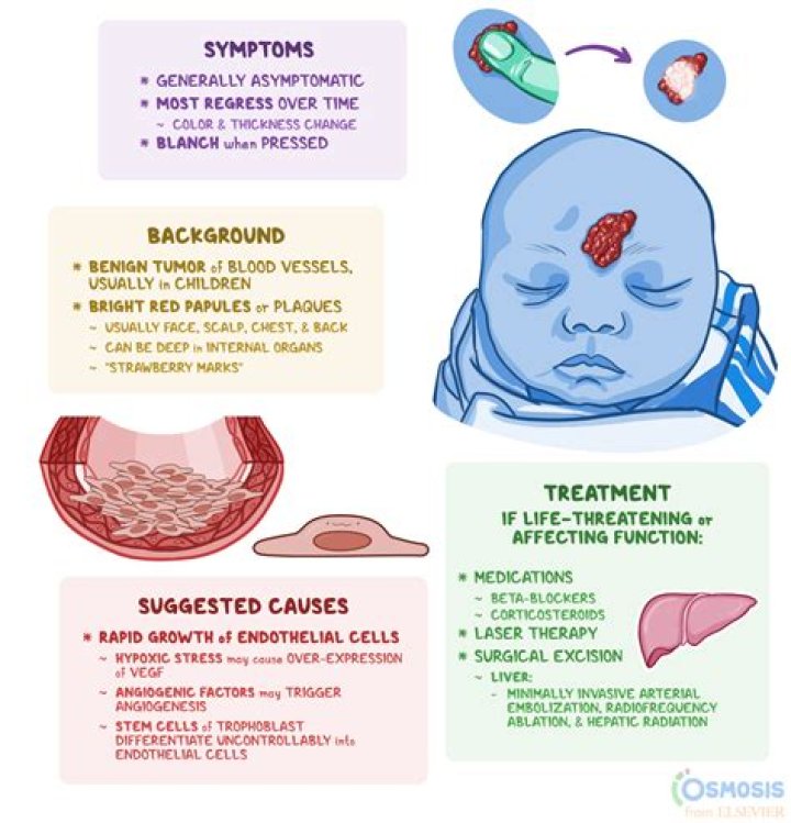 Can a hemangioma cause death?