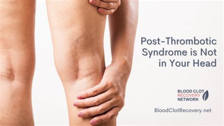 Can blood thinners cause joint pain?