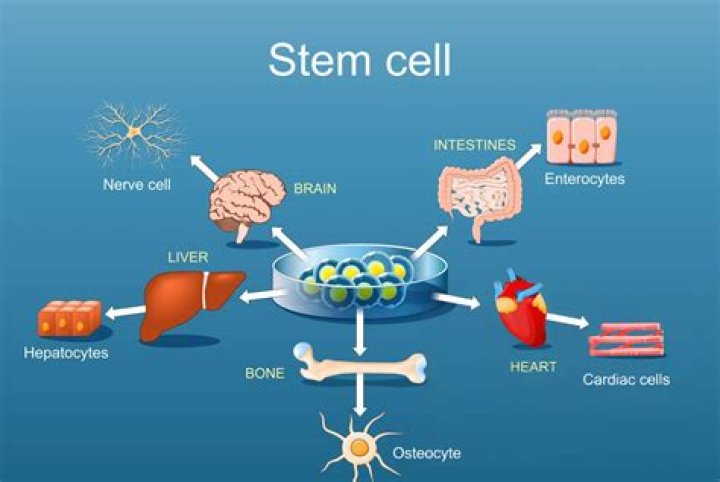 Can stem cell replace hip replacement?