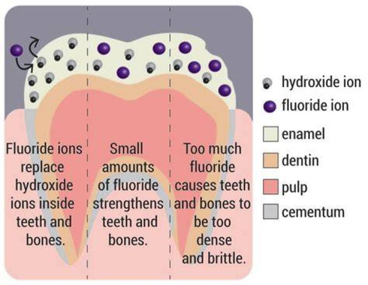 Can you have a reaction to fluoride?