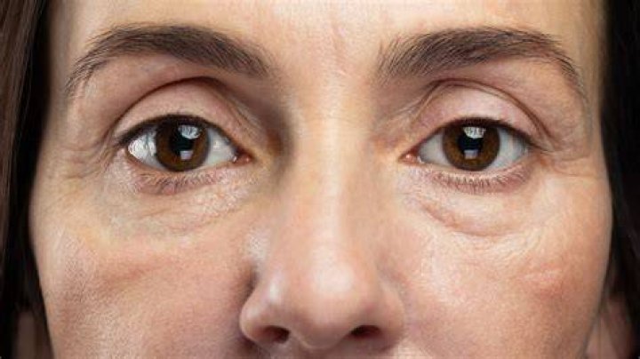 Can you use my perfect eyes around the mouth?
