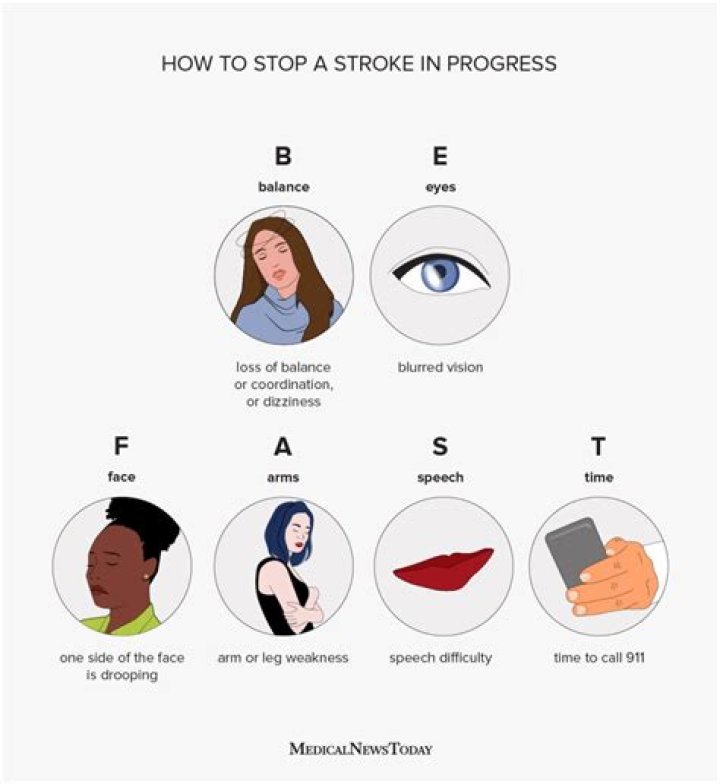 Does a stroke change a person's personality?