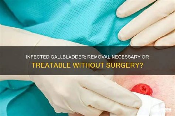 Does an infected gallbladder have to be removed?