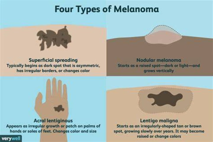 Does melanoma hurt to the touch?