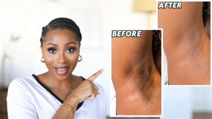 Does shaving armpits darken skin?