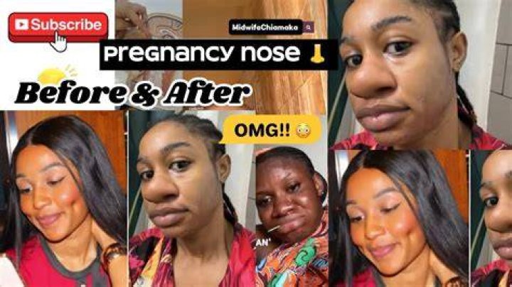 Does your nose get bigger after having a baby?