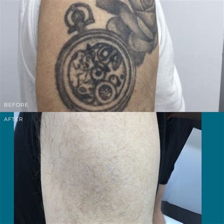 Has a dog ever had a tattoo?