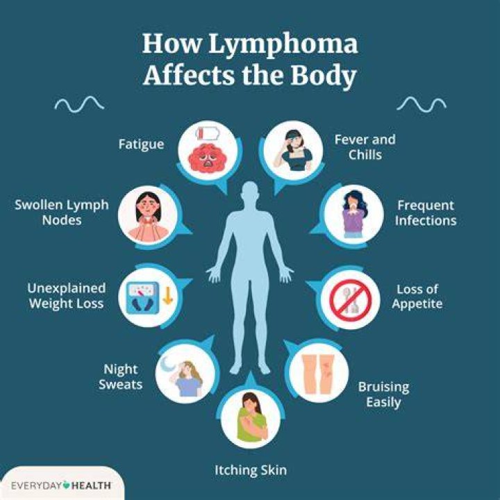 How do I know I don't have lymphoma?