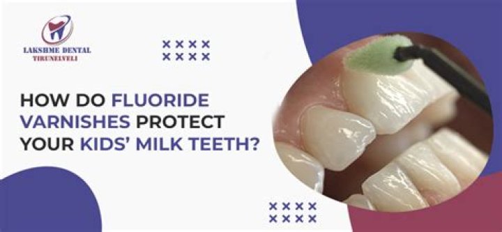 How do you apply fluoride varnish to teeth?
