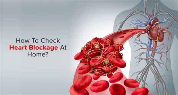 How do you check for heart blockage without angiography?