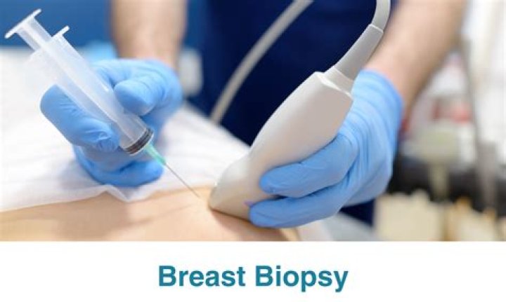 How long does a biopsy take to get results?