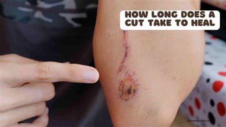 How long does it take for a port to heal?