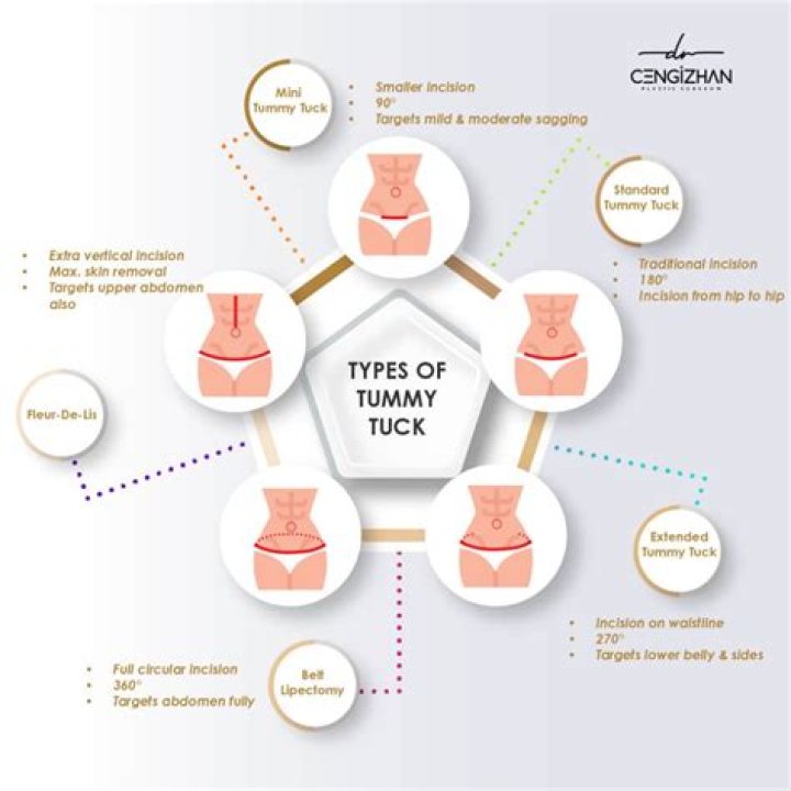 How much weight does a tummy tuck take off?