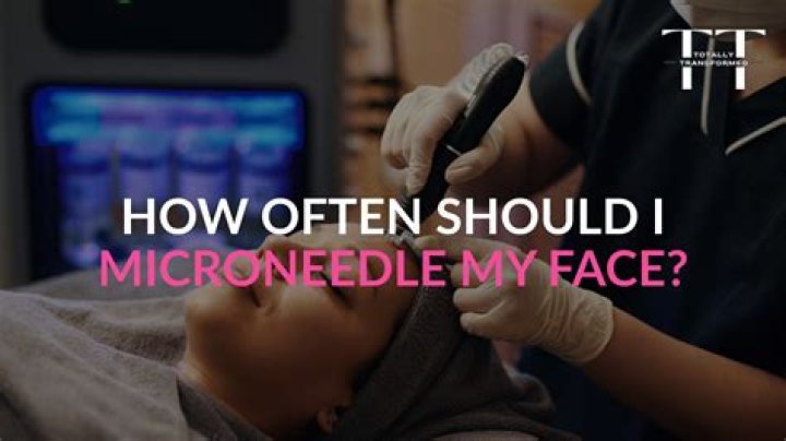 How often should I microneedle a scar?