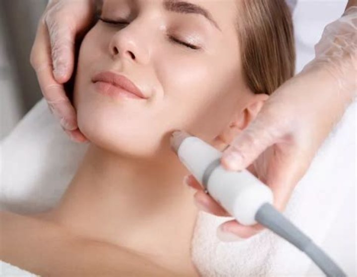 How often should microdermabrasion be done?