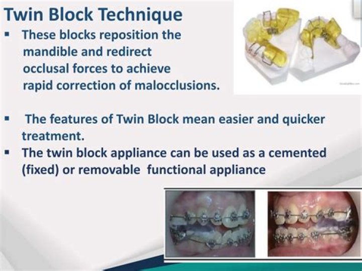 How rare is a twin tooth?