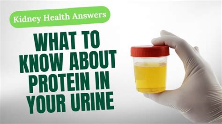 Is there protein in urine?