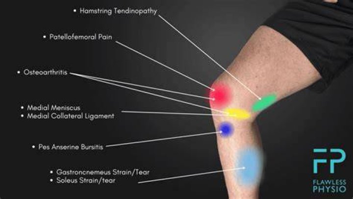 Should I rest a sore knee?