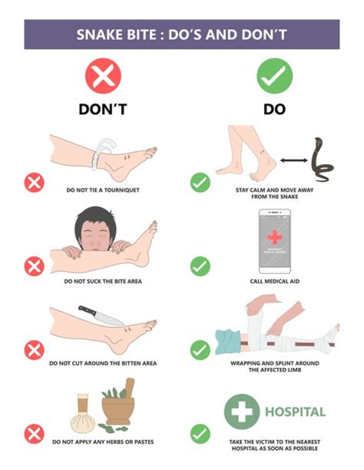 What are 4 things you should not do for a snake bite?