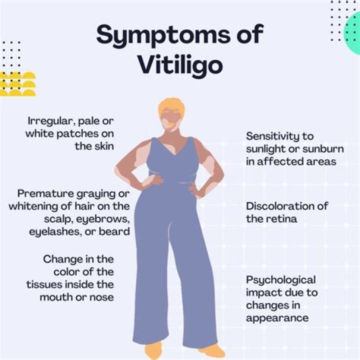 What causes vitiligo later in life?