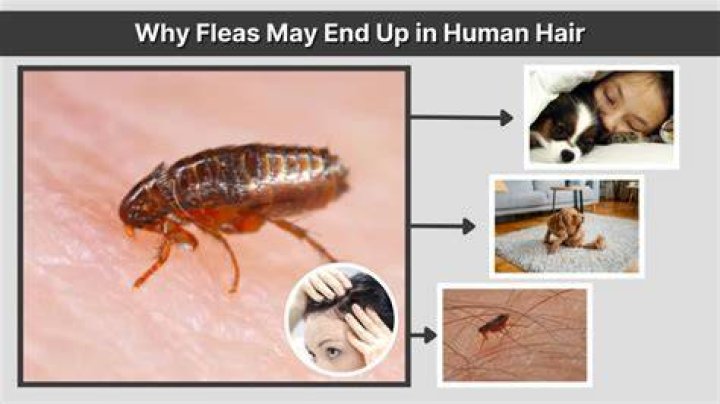 What do fleas feel like in human hair?