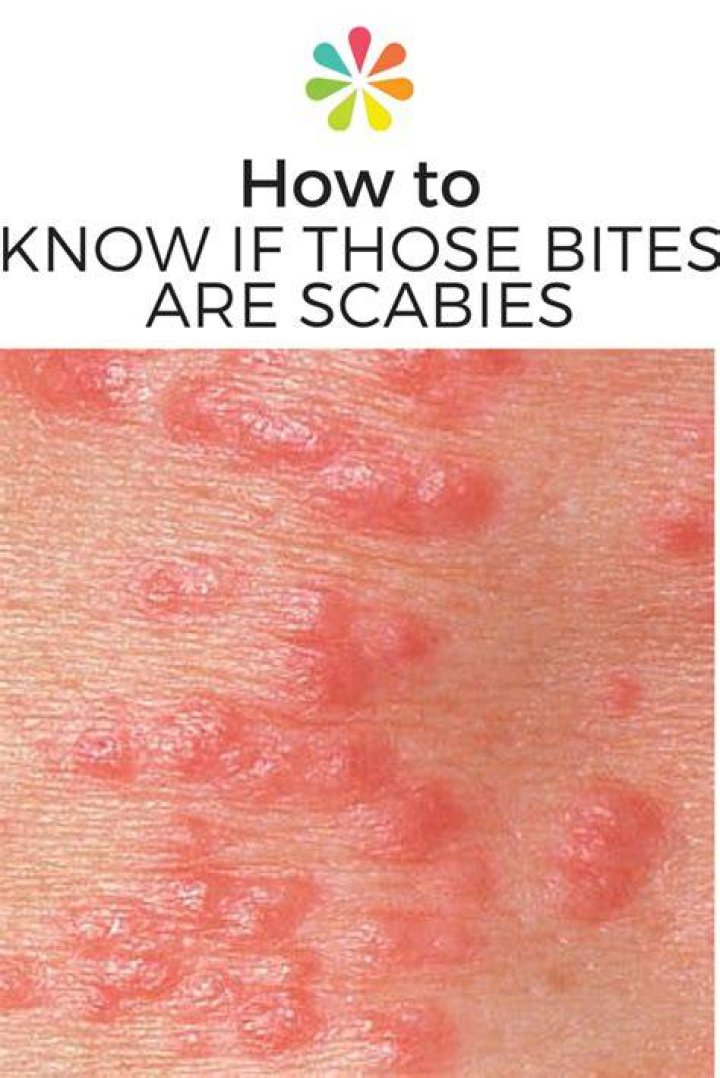 What does a scabies rash look like?