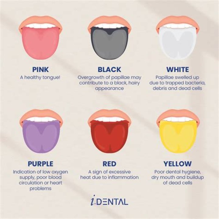 What does it mean when your skin doesn't bounce back?