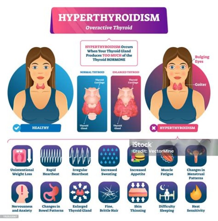 What happens if thyroid is high?