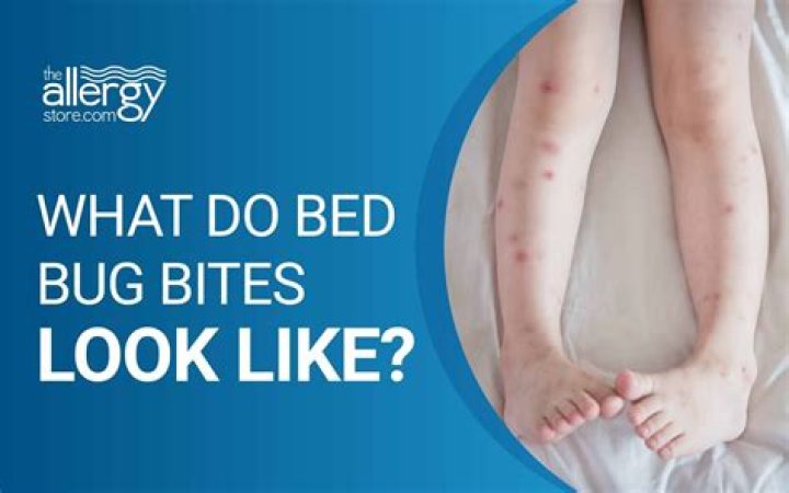 What time of day do bed bugs bite?