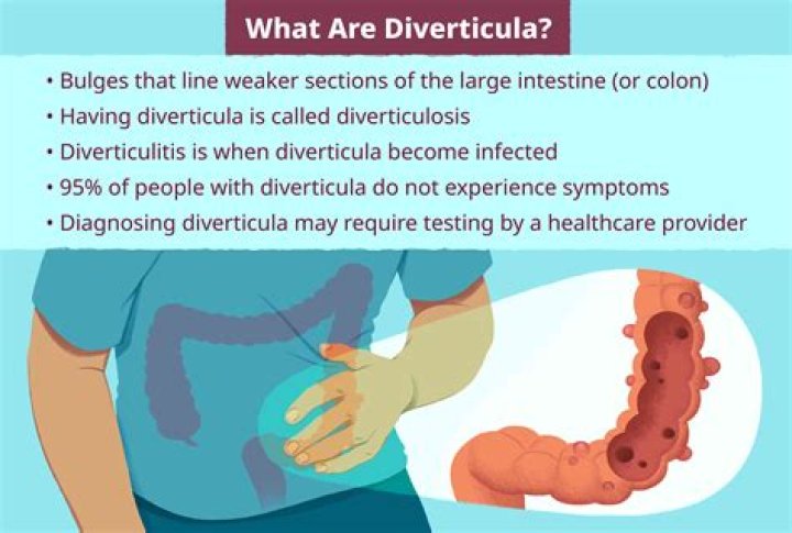 Who is most at risk for diverticulitis?
