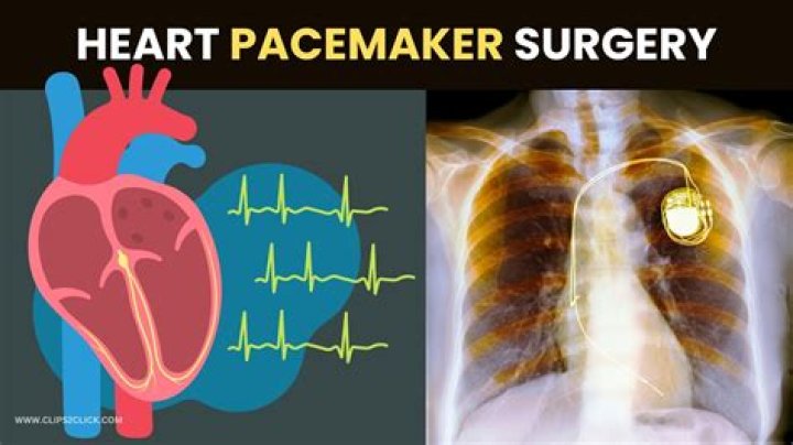 Why am I so tired after my pacemaker surgery?