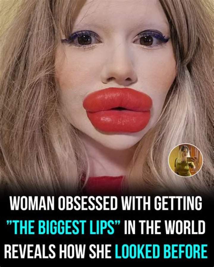 Why are girls obsessed with big lips?