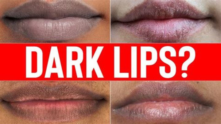 Why are top lips darker?