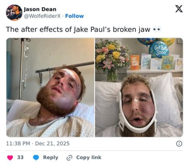 Why did Jake and April break up?