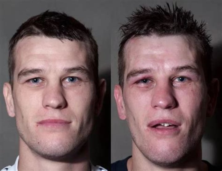 Why do boxers cut their eyes?