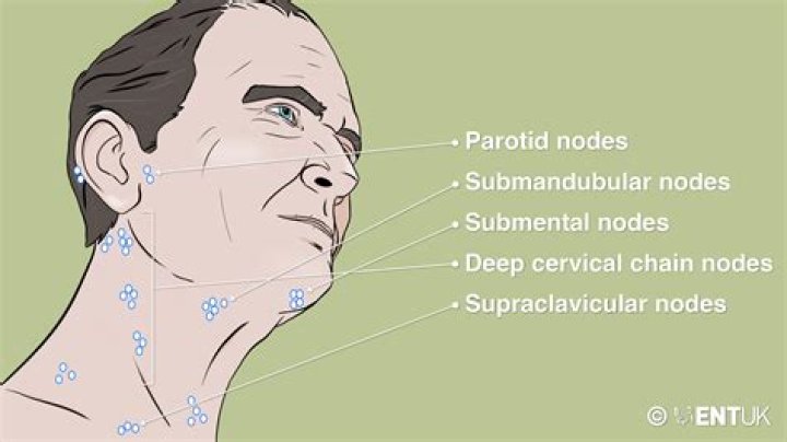 Why do my lymph nodes in neck hurt?