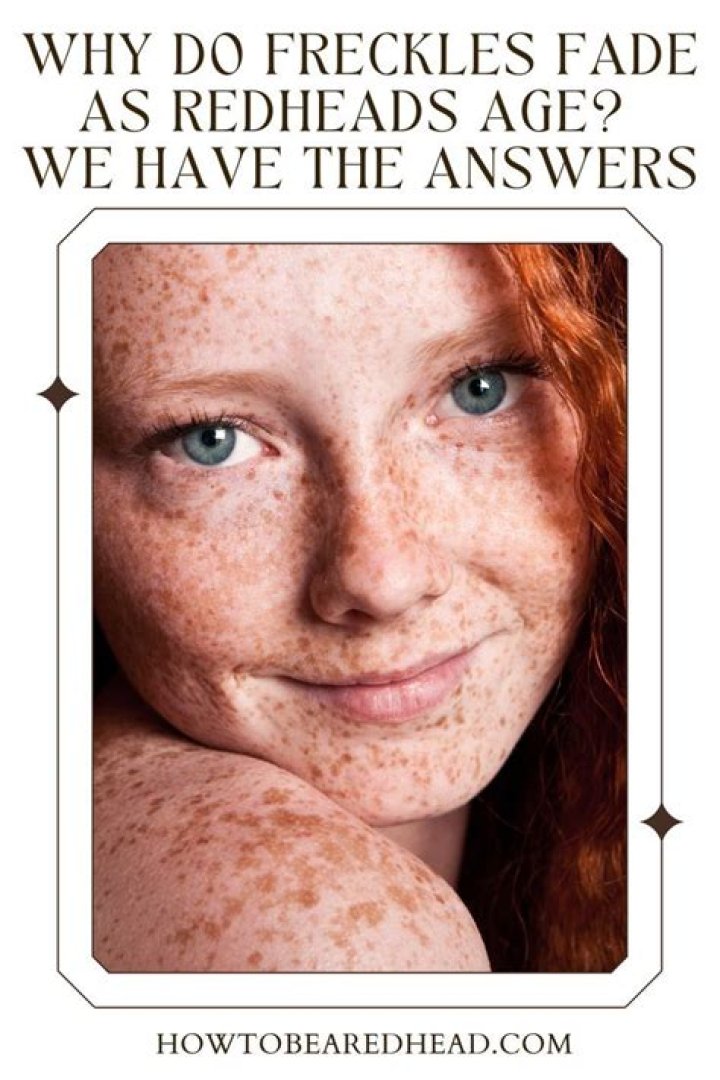 Why do some redheads not have freckles?