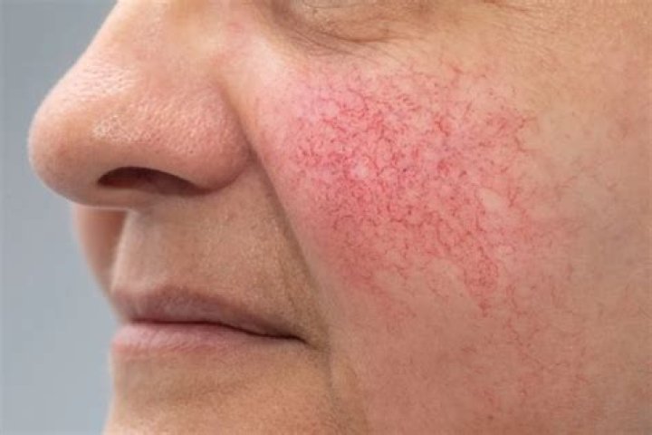 Why is my old scar turning red?