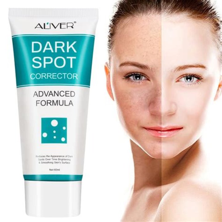 Will toothpaste remove dark spots?